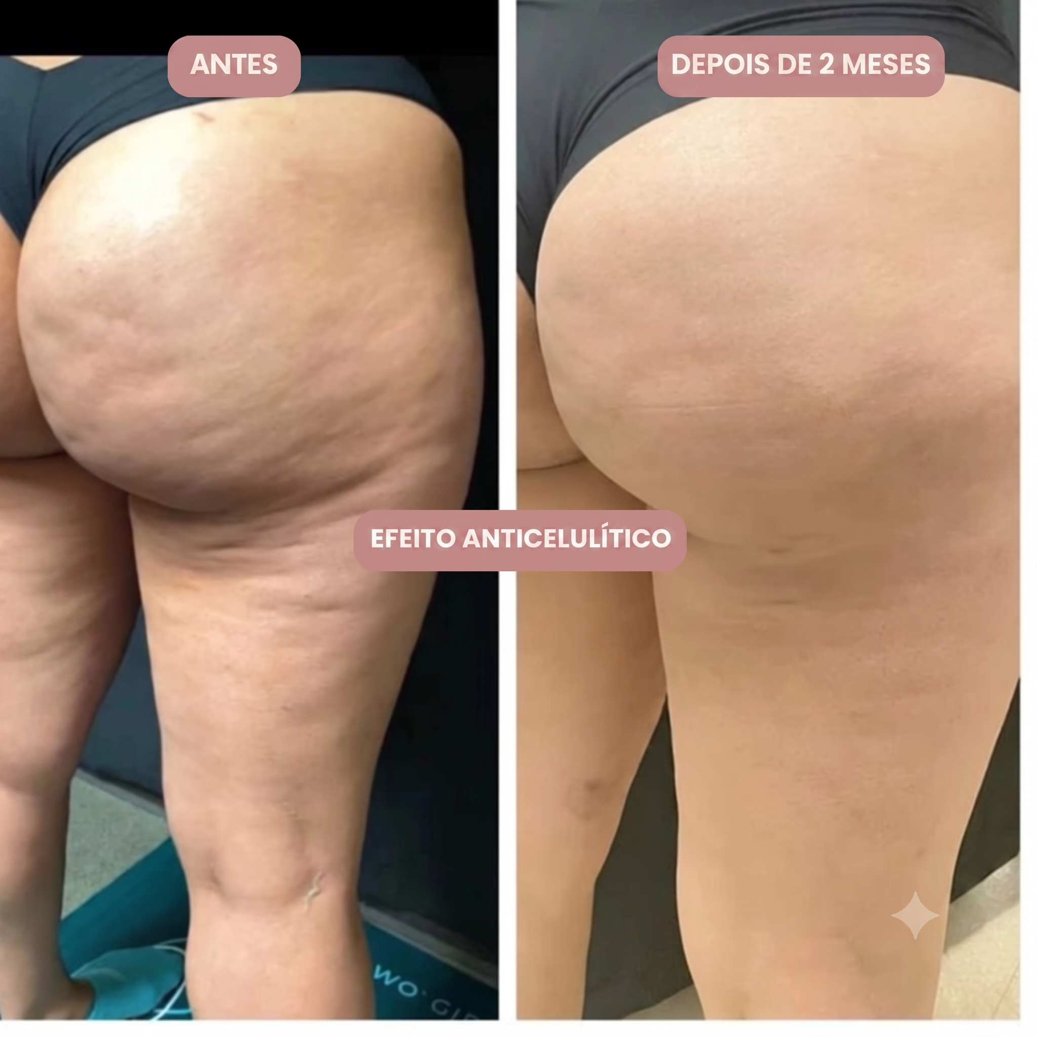 Legging 3D Anti-Celulite Coraluz™