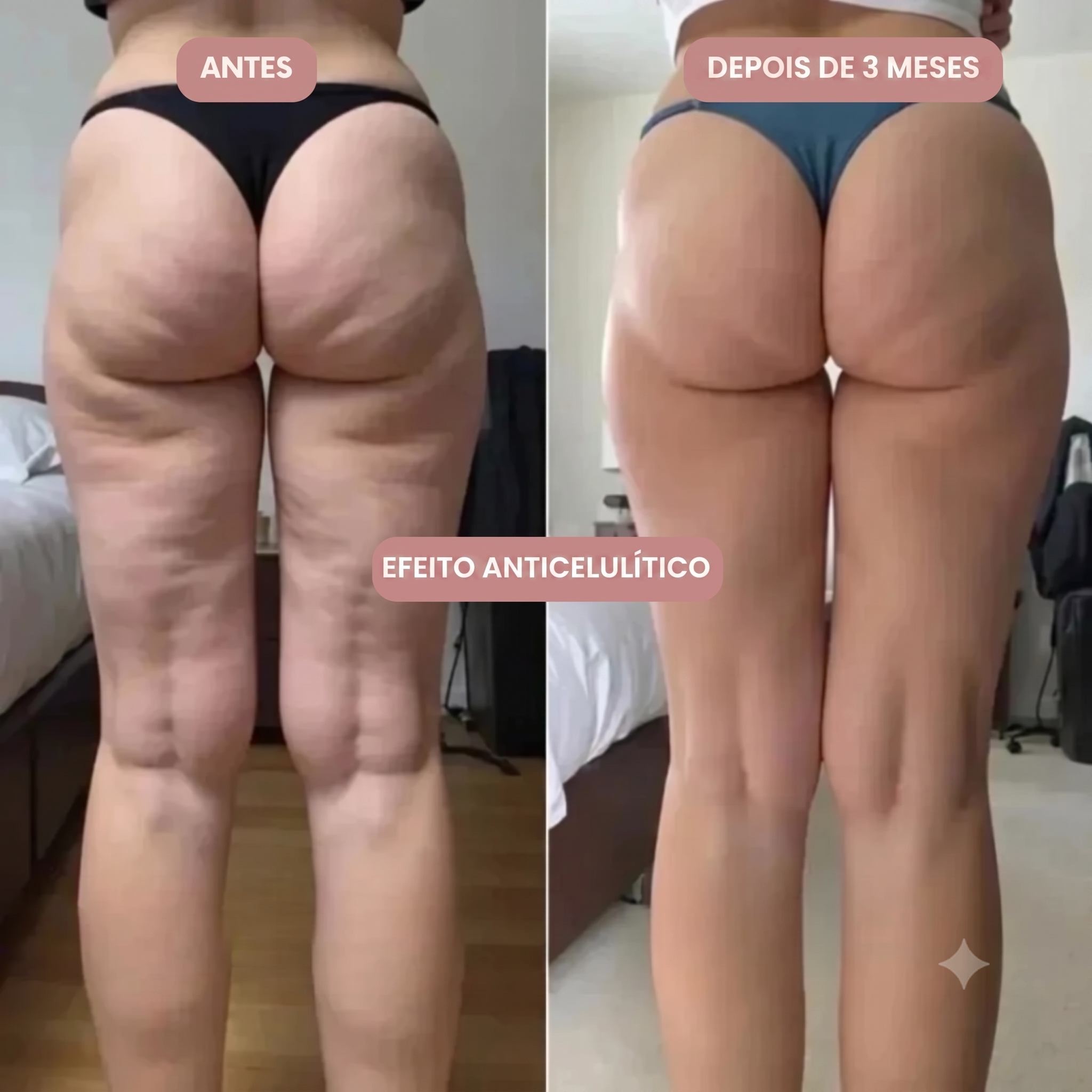 Legging 3D Anti-Celulite Coraluz™